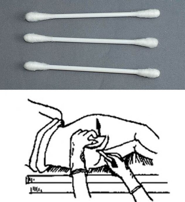 Análise Sticks