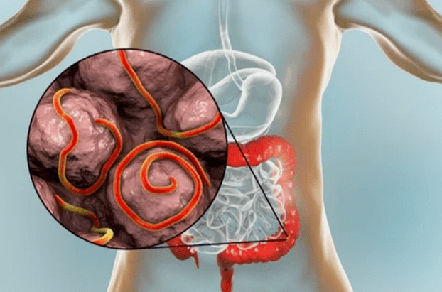 Parasitas no corpo