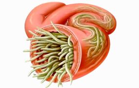 Como limpar o intestino de parasitas