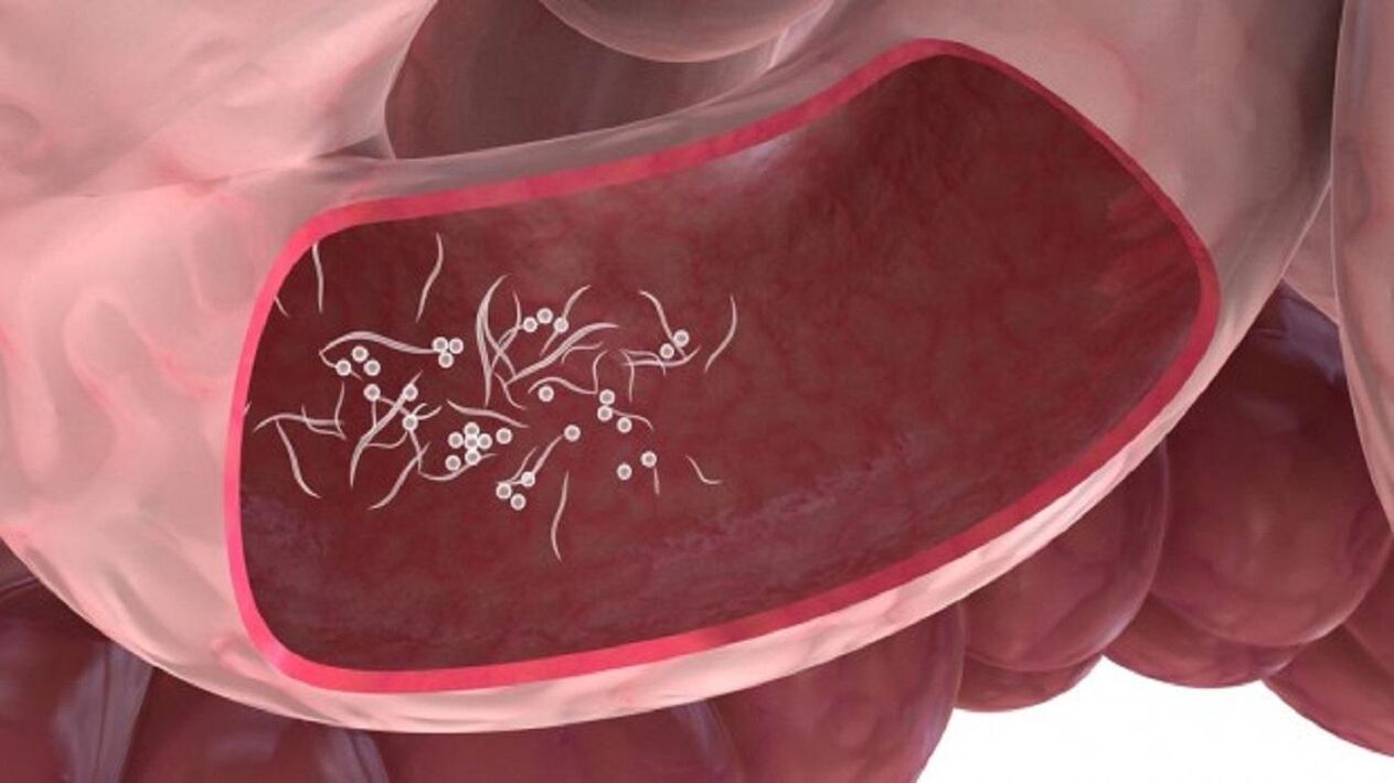 Parasitas Giardia no fígado