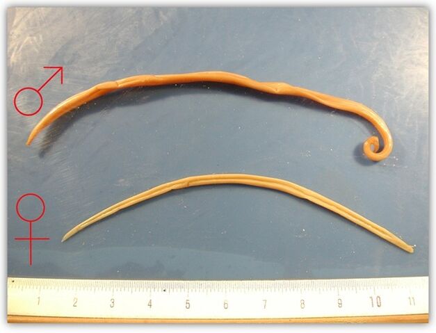 como são as lombrigas