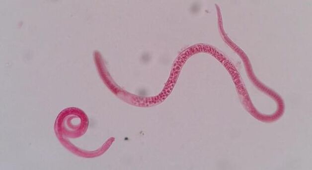 como é a triquinela