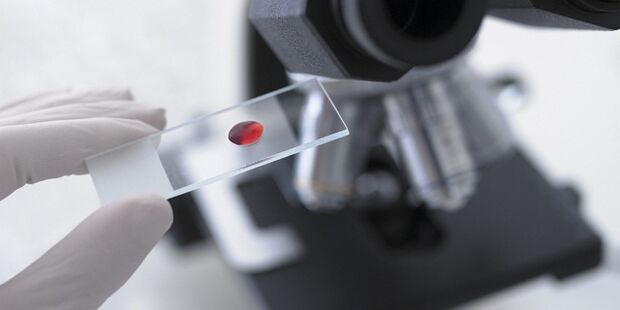 exame de sangue para diagnosticar parasitas no corpo